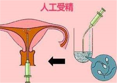借卵做试管婴儿移植后早孕期阴道出血该怎么办？