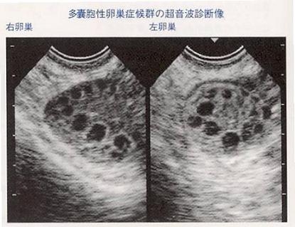 湖南长沙妇幼保健院供卵试管婴儿哪个试管医生最好