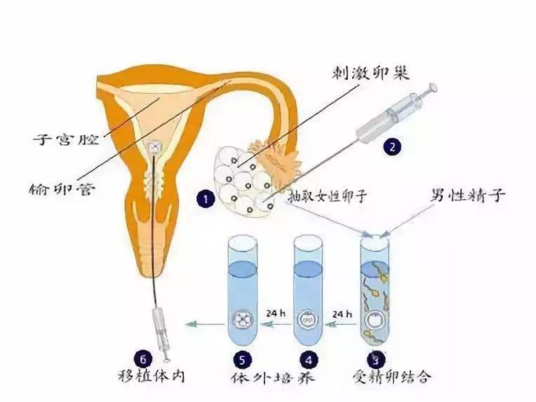 27岁卵巢早衰卵泡少试管促排的成功率大吗